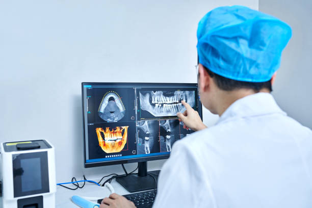 Best Knocked-Out Tooth (Avulsed Tooth) Treatment in El Cerrito, CA